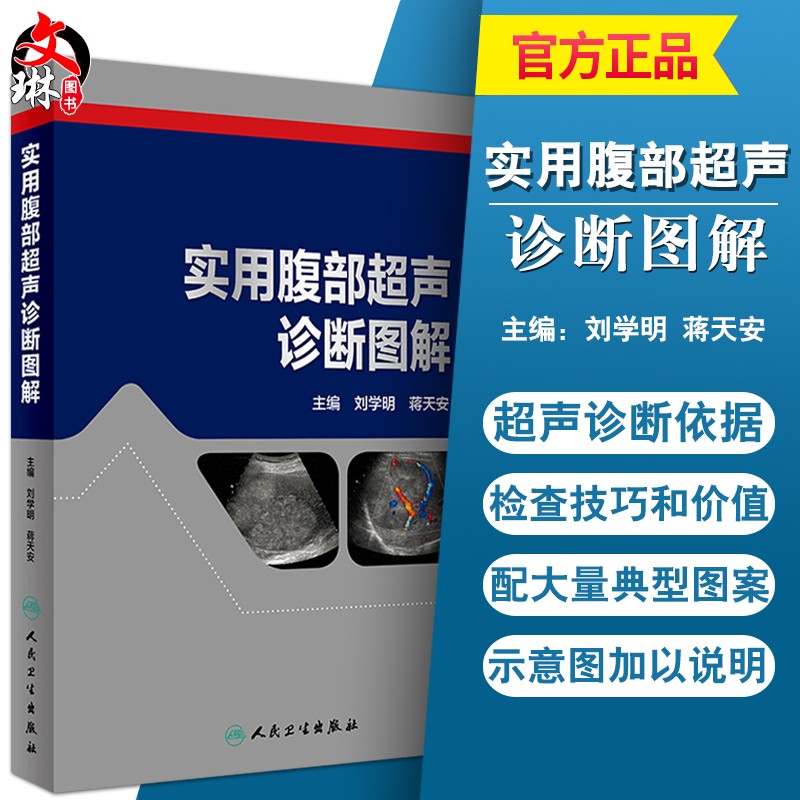 正版 实用腹部超声诊断手册图解 刘学明 蒋天安主编 人民卫生出版社 腹部疾病 超声波诊断图解 医学超