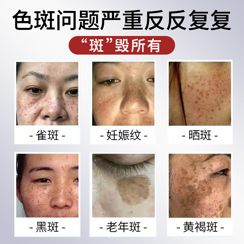 百灵鸟烟酰胺原液美白精华美白淡斑去斑淡化黑色素维生素b3烟酰胺男女士