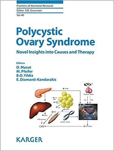 预订 polycystic ovary syndrome: novel insights into causes and