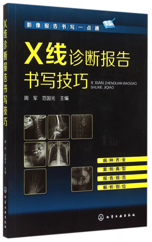 X线诊断报告书写技巧(影像报告书写一点通)