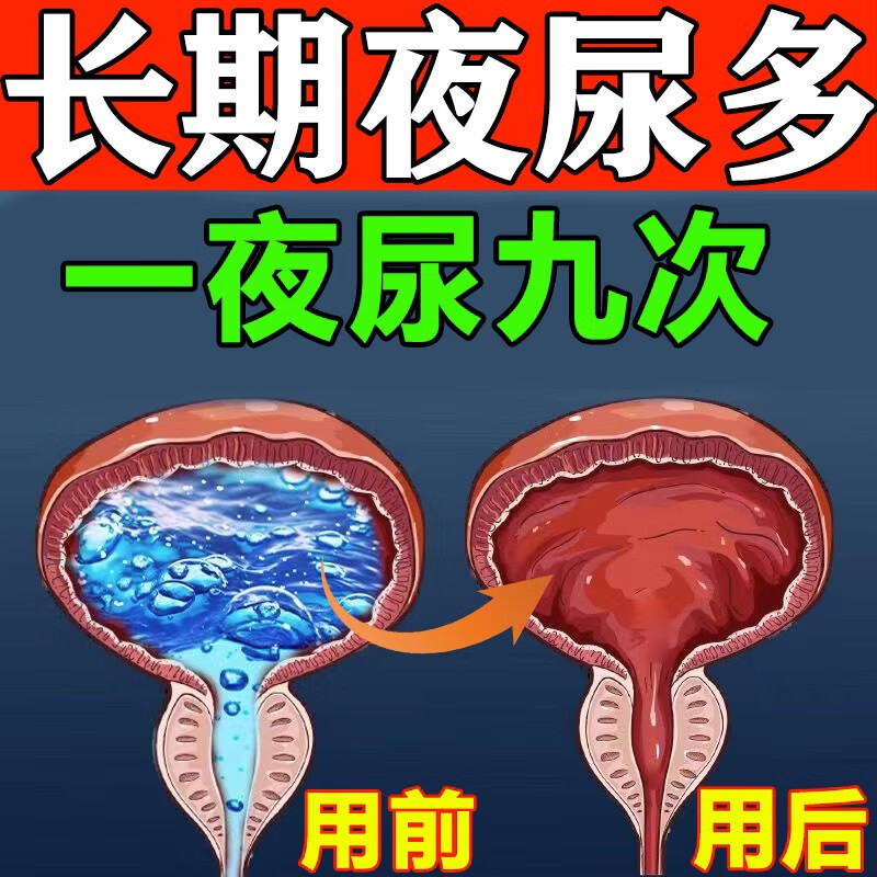贴夜尿频多男性尿频尿急尿不尽半夜老起夜尿道灼热疼痛排尿困难尿 一