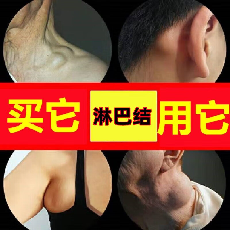 淋巴贴通络贴搭甲状腺结节贴颈部耳后下颌淋巴肿大腋下副乳疏通贴 单