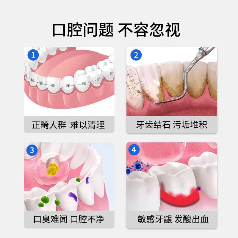 帝优美冲牙器便携式洗牙器水牙线声波洁牙器 正畸敏感家用口腔清洁预防牙结石 礼物送男女朋友实用 【升级冲力大小可调节】T8薄荷清晨 4支喷头