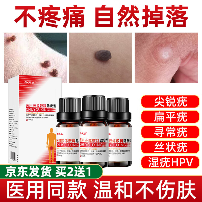 誉芙美除疣型男女性肛周私密处尖锐湿疣除疣液丝状疣假性疣生殖器尖锐