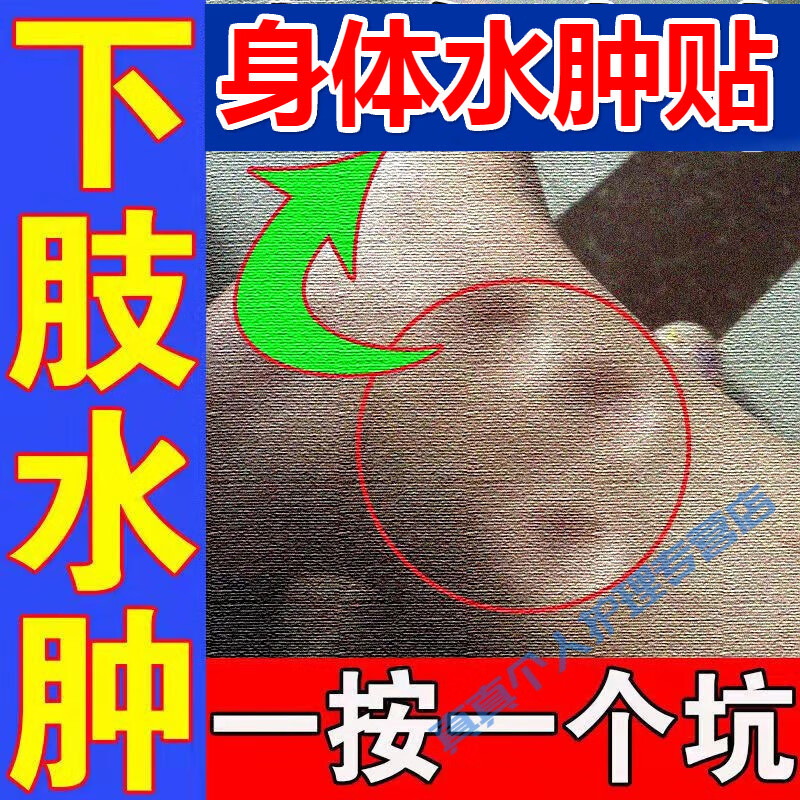 梵贞【去全身水肿】下肢水肿去老人脚肿腿肿脸肿小腿水肿内分秘水肿贴
