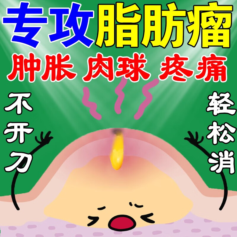 脂肪瘤专的去除膏成人3天消专消36种皮下多发性脂肪瘤硬块 单盒[缓解