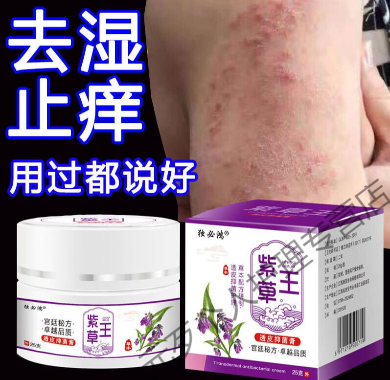 皮l炎湿l疹皮肤瘙痒汗i疱l疹荨l麻疹湿毒牛皮l癣热痒银i屑癬藓抑菌