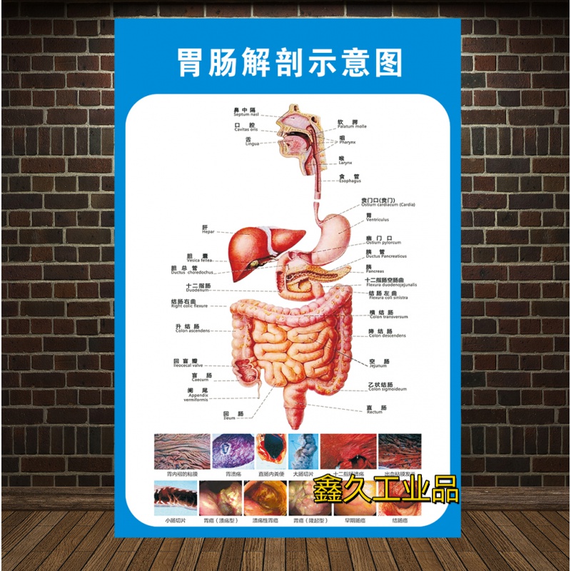 定制适用胃肠解剖示意图人体解剖医学挂图人体器官心脏结构图医院宣传