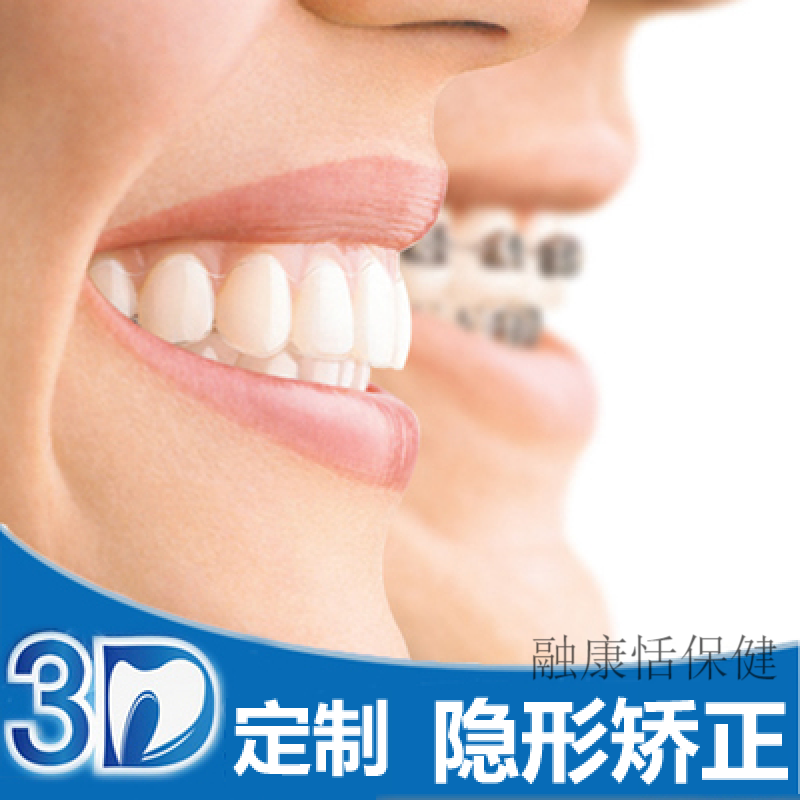 地包天牙齿矫正牵引器 牙齿器纠正隐形牙套凸嘴门牙龅牙固定地包天