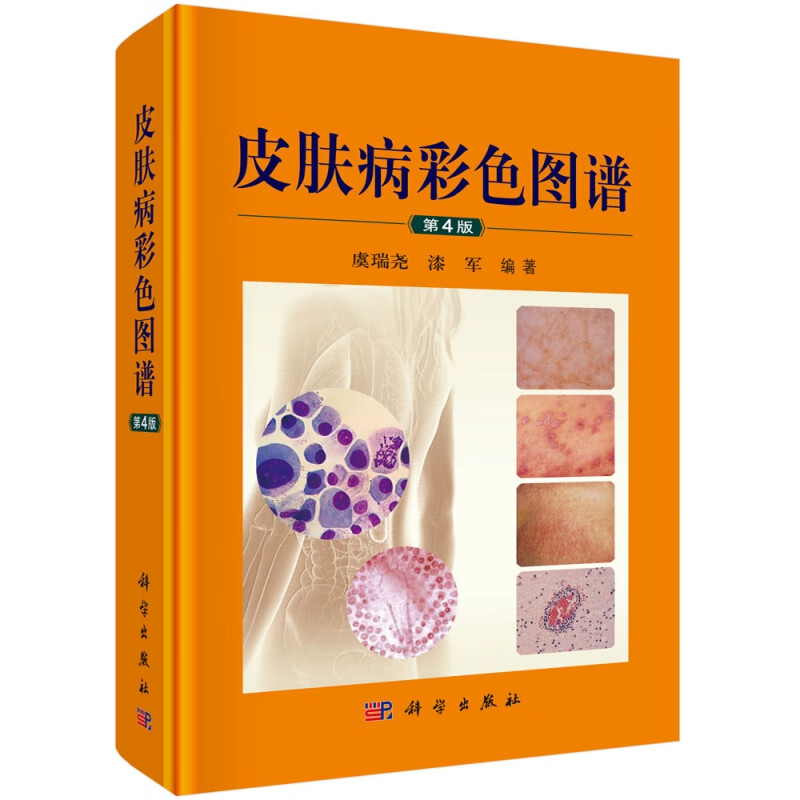 皮肤病彩色图谱(第4版)(精)