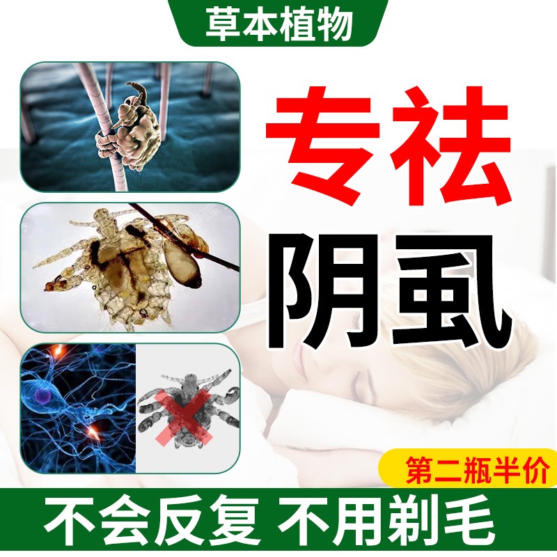 易控【一瓶抵多瓶】百部酊虱子药头虱虱立净除虱卵阴虱男女私处专用药 一瓶装大容量 100ml