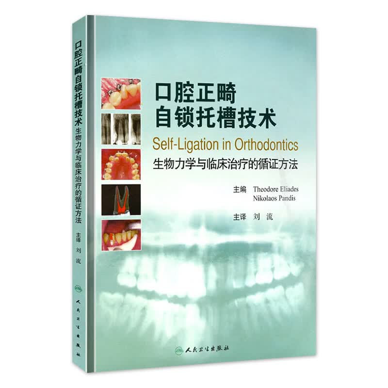 口腔正畸自锁托槽技术
