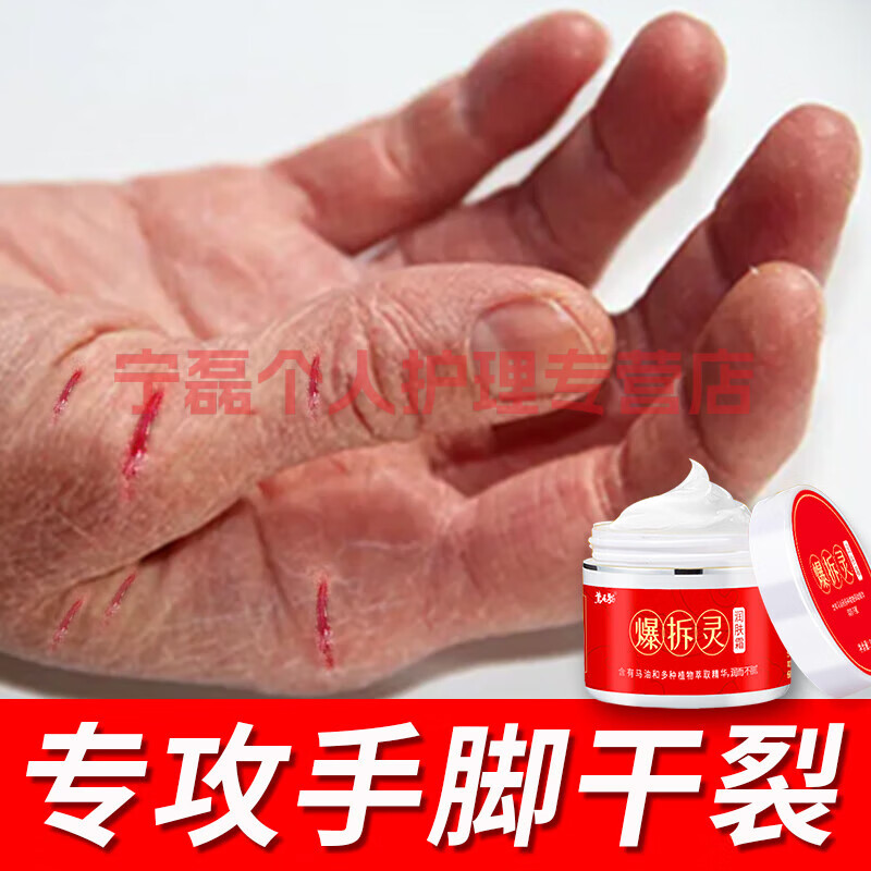 爆拆灵润肤手足皲裂膏脚后跟干裂修复防皴裂护手霜 3盒 1盒