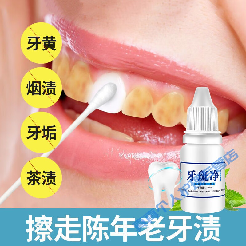 梵贞牙斑净去牙齿发黄牙黑去除牙渍口腔异味牙垢口干舌燥口腔溃烂 1