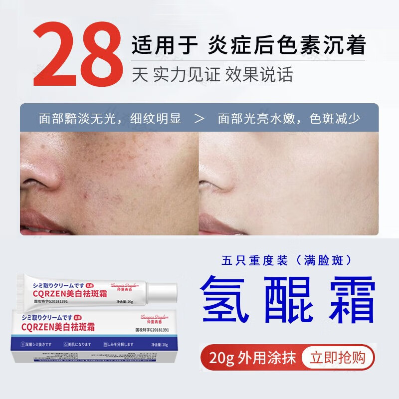 氢醌乳膏医用 氢醌霜乳膏分解黑色素沉淀复方熊果苷乳膏 祛斑氢醌霜