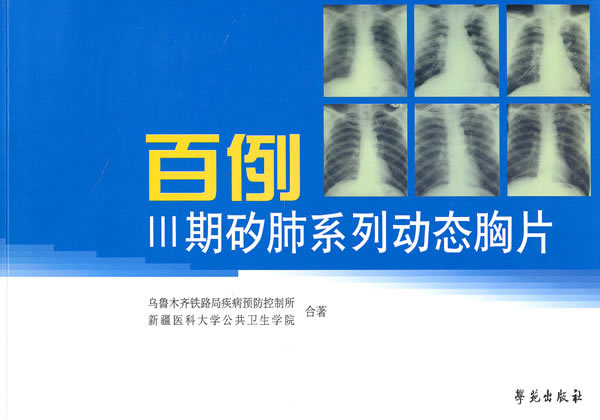 百例iii期矽肺系列动态胸片乌市铁路疾病控制所等学苑出版社【关注有