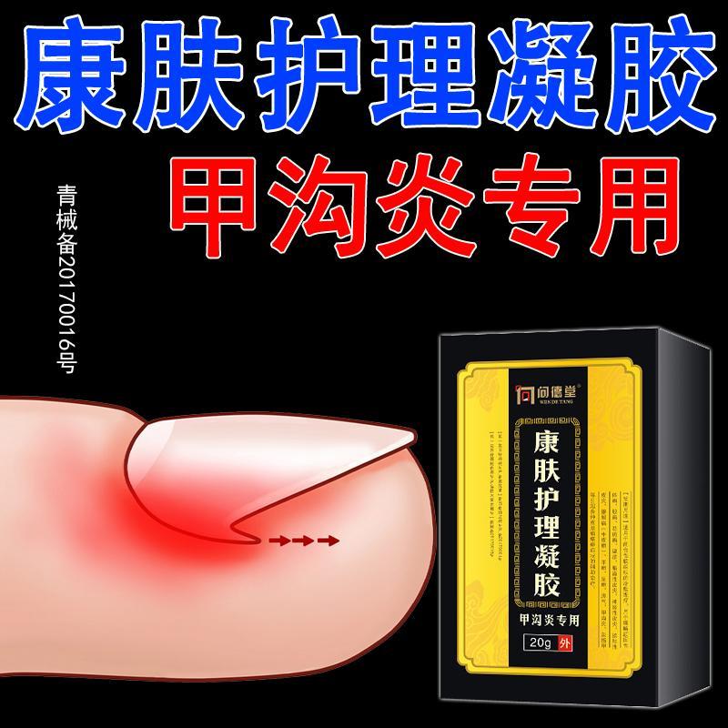 问德甲沟炎专用液康肤护理凝胶辅助甲沟a1 1盒凝胶