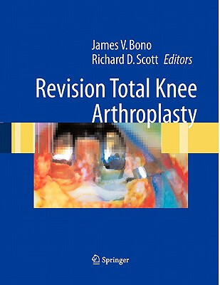 预订 revision total knee arthroplasty
