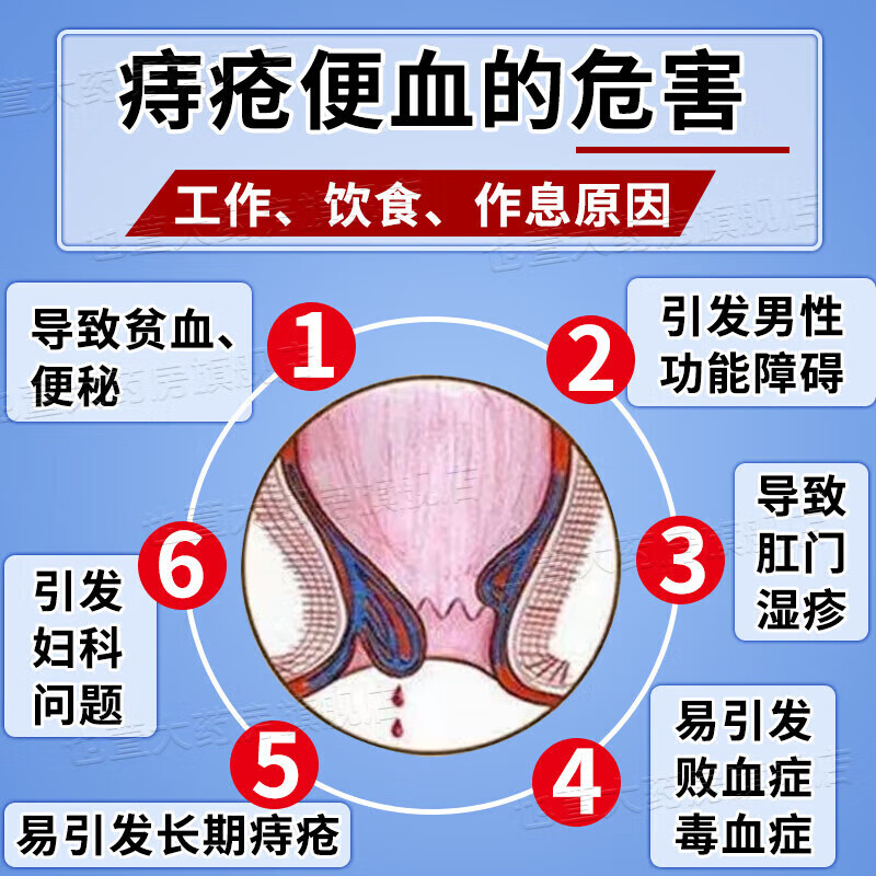 槐角丸治痔疮特专用药 马应龙痔疮膏去肉球痔疮便秘大便出血肛门瘙痒肿痛肛门肉球肛裂便血拉血止血药 1盒【痔疮疼痛】