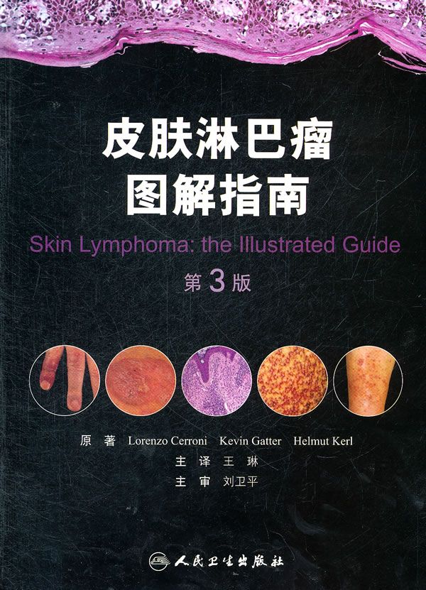 皮肤淋巴瘤图解指南第3版