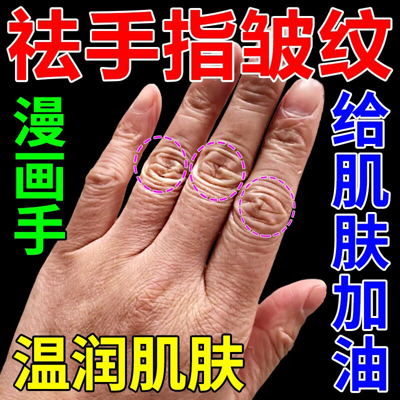 去手指关节皱纹美肌手背暗沉发黑生长纹粗糙修护美白肌肤保湿祛除 单