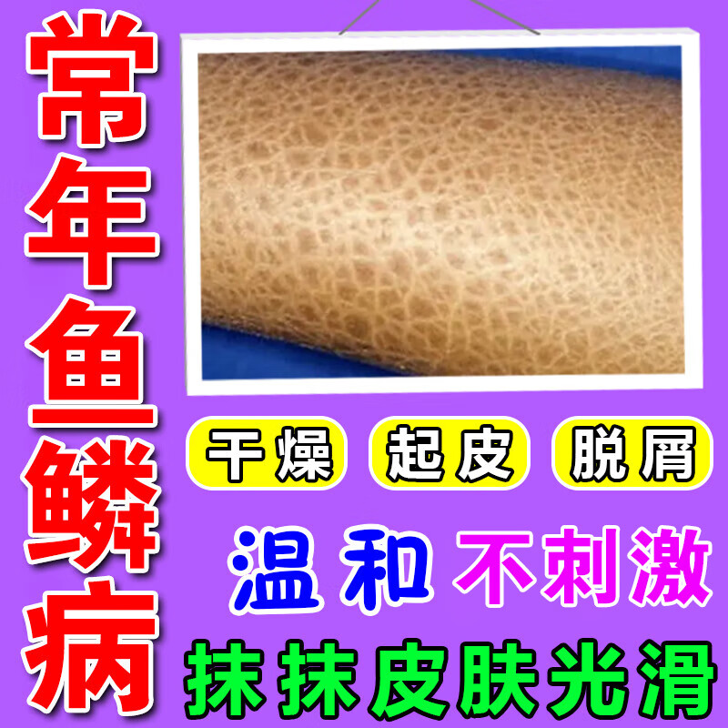 全身身体乳大小腿上去蛇皮干燥起脱皮鸡皮毛囊角化质病c 单盒装