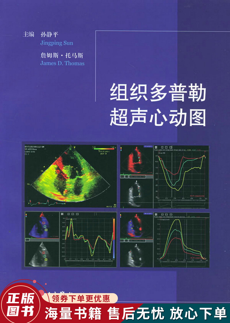 组织多普勒超声心动图