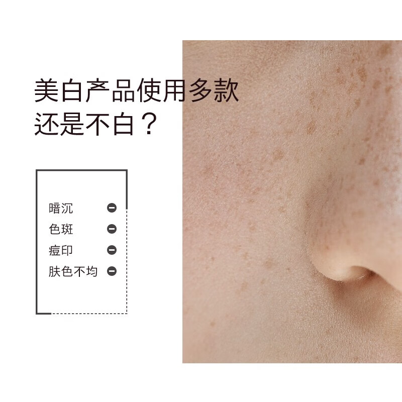 雪完美(PXE) 雪完美美白祛斑霜保湿面霜护肤品化妆品烟酰胺淡斑霜滋润补水霜 美白祛斑霜50g