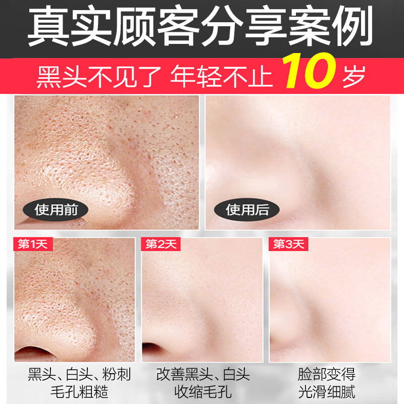 【毛孔粗大救星】排出脏东西 比荷荷巴油好用 第三代果酸收缩毛孔精华液水男女 乳糖酸精华水【拍2到手3瓶】