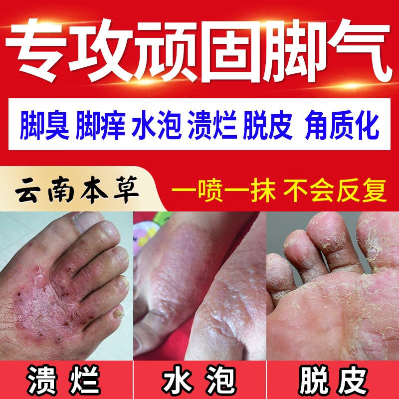 分析护足霜价格走势|护足霜价格走势