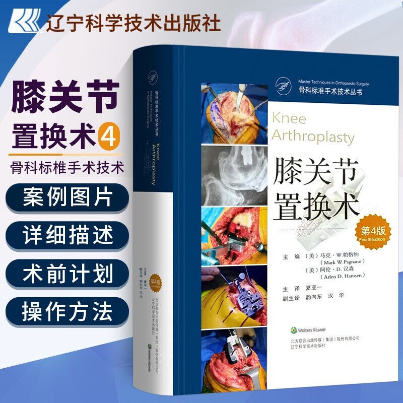 膝关节置换术(第4版)辽宁科学技术出版社有限责任公司9787559121653 医学书籍