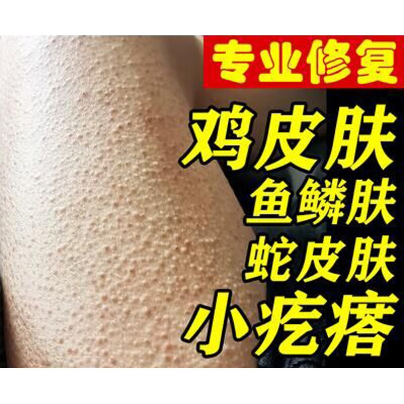 蛙泳手臂鸡皮肤(蛙泳手臂技术动作) 蛙泳手臂鸡皮肤(蛙泳手臂技术动作)