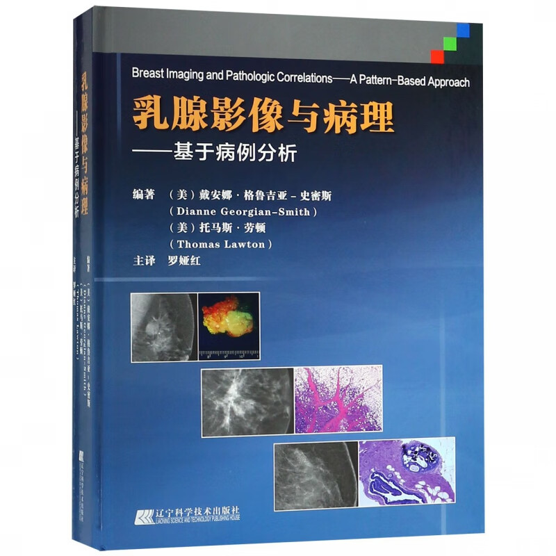 乳腺影像与病理--基于病例分析(精)