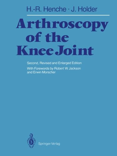 预订 arthroscopy of the knee joint