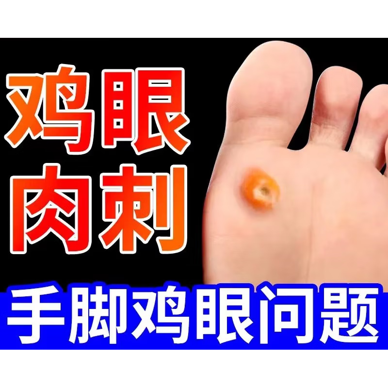 1盒装(鸡眼跖疣肉刺老茧)