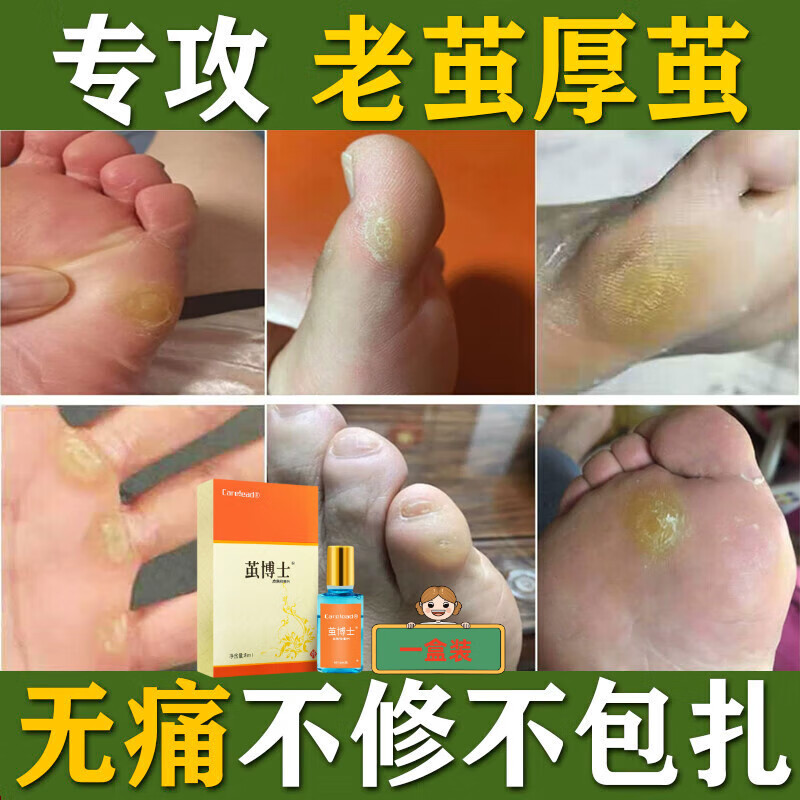 皓妆主【官方】茧子去除膏茧博士清茧灵祛老茧脚底厚茧死皮角质脚茧软化 茧博士皮肤液*1盒