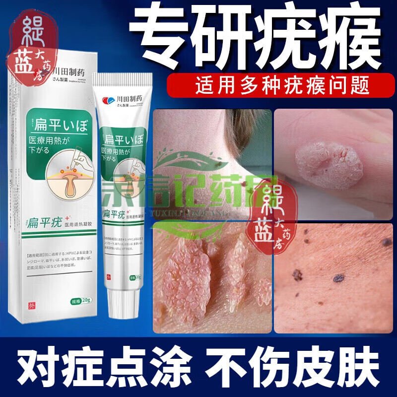 【药房直售】扁平疣软膏日本技术搭克疣净去猴子脖子肉粒温和不留巴去