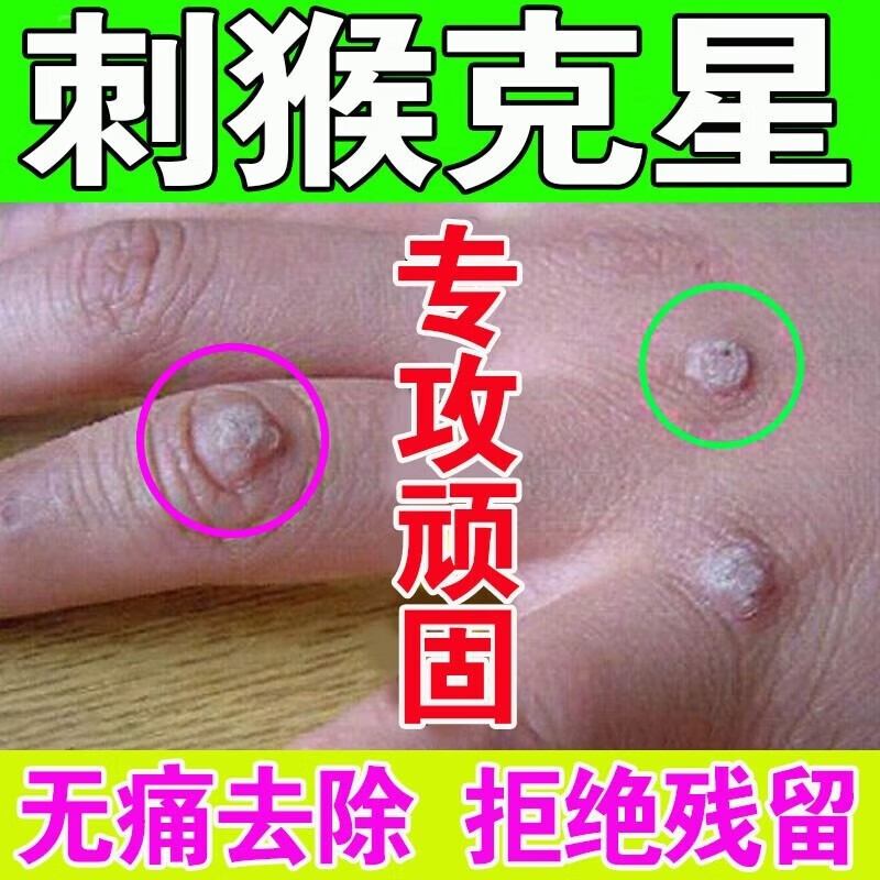 男性私处女性自检hpv病毒私处湿痒疹瘙痒扁平疣珍珠疹去除脖子小肉粒