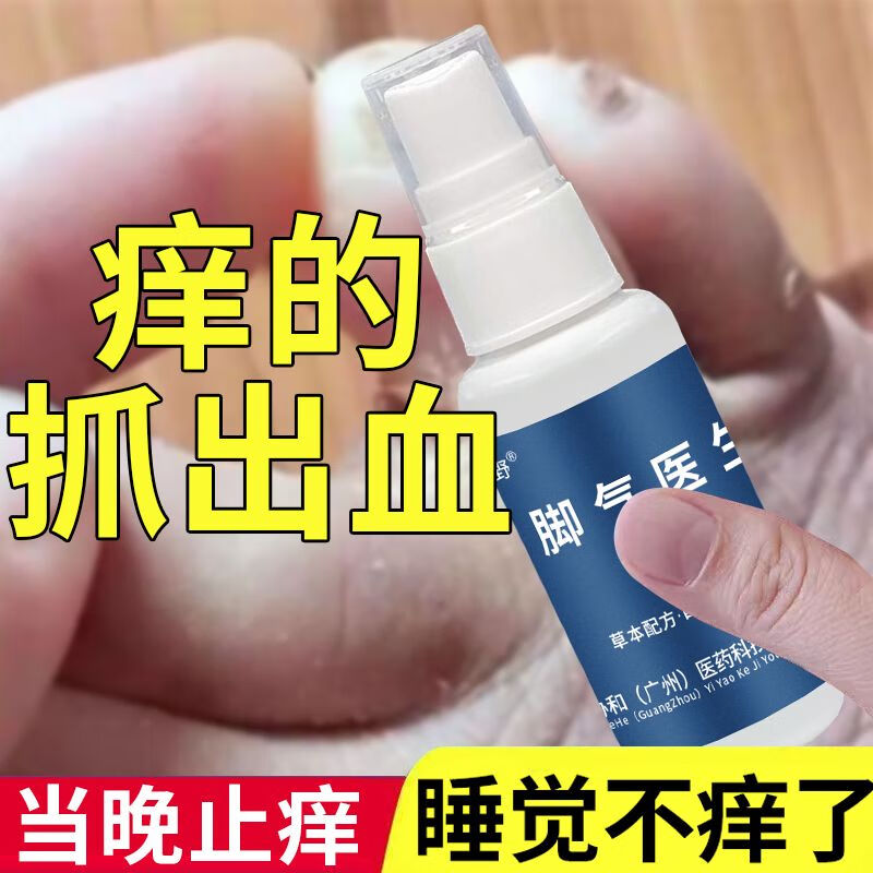 梦鱼野脚气喷剂脚气王脚痒除l臭脱皮痒脚真菌感染脚