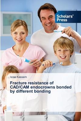 预订fracture resistance of cad/cam endocrowns bonded