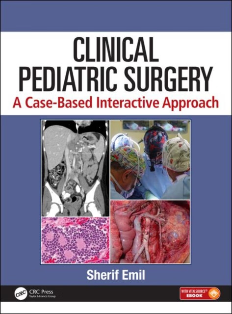 预订 clinical pediatric surgery