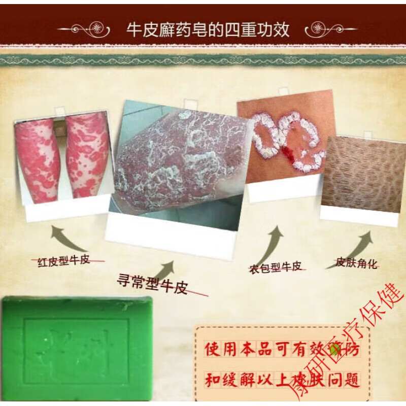 手工皂克癣螨虫皂硫磺皂洗脸粉刺洗头控油洗脚洗手洗澡沐浴皂去油净肤