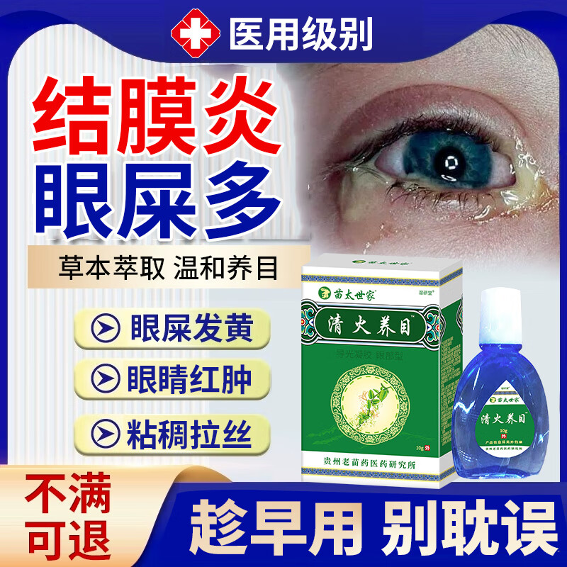 结膜炎眼屎多眼药水眼睛上火有眼屎粘稠多视线模糊滴眼液红血丝早起全