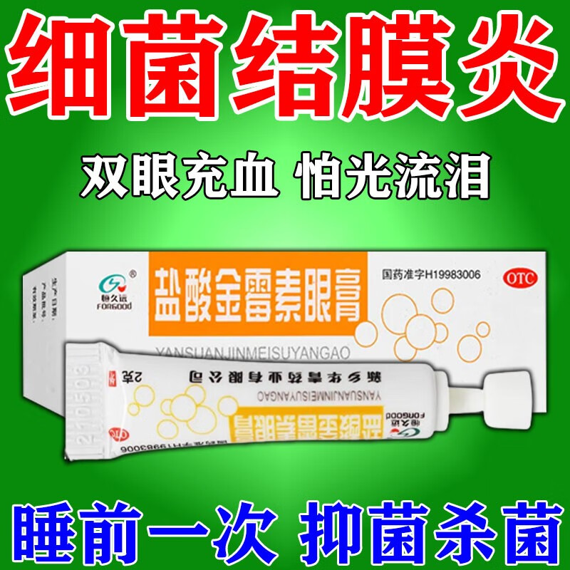 治结膜炎眼膏慢性结膜炎细菌性结膜炎眼睛发痒结膜充血红肿疼痛眼干眼