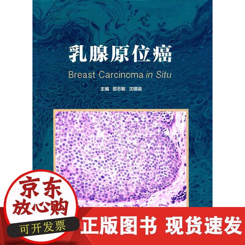 【正版现货】乳腺原位癌