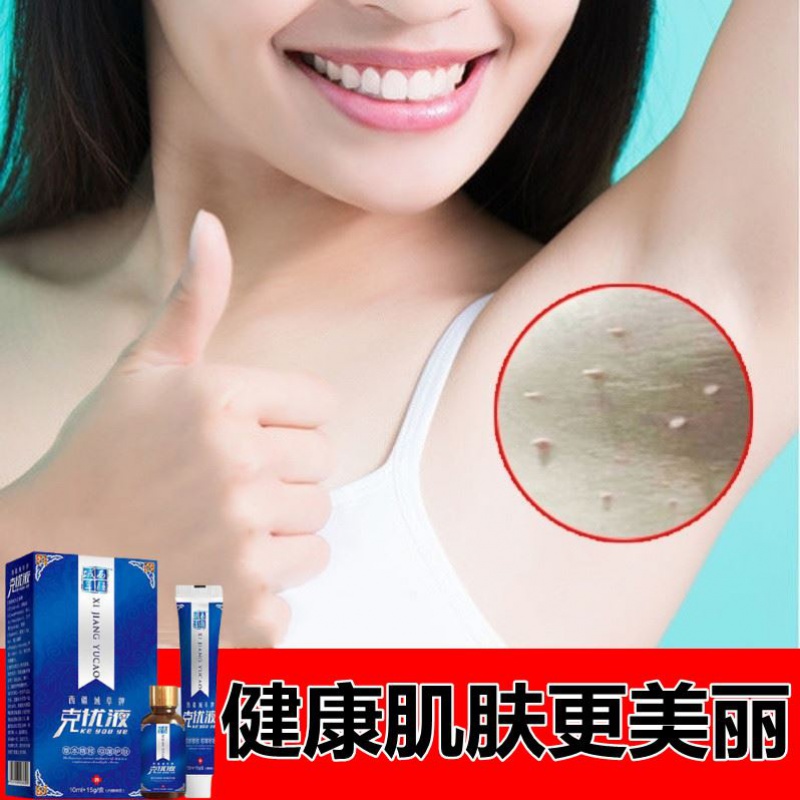 脖子上长的小肉粒疙瘩去除膏身上腋下皮赘去丝状尤疣猴子点痦子子