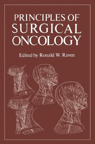 预订 principles of surgical oncology