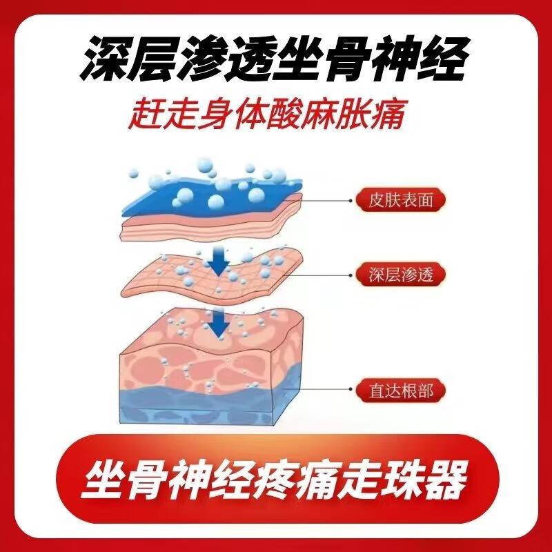 金力康坐骨神经疼痛专用凝胶腰疼屁股疼腰间盘突出压迫神经腿疼大小腿麻 1盒装