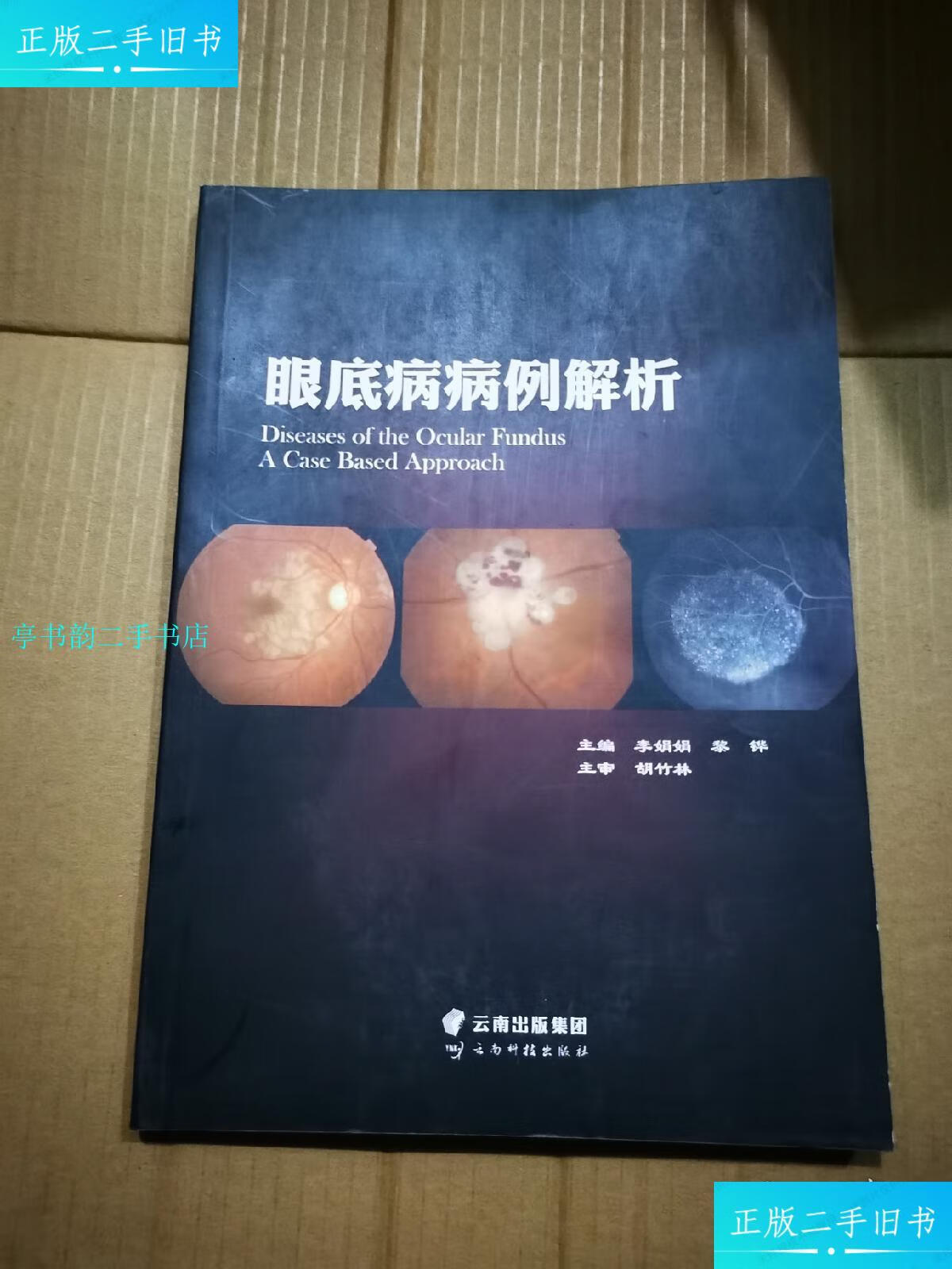 【二手9成新】眼底病病例解析.全彩图/李娟娟云南出版集团