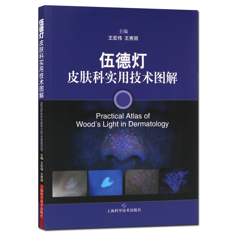 伍德灯皮肤科实用技术图解 皮肤科治疗学书籍 上海科学技术出版社